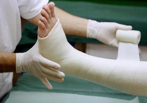За выходные более 50 бердянцев получили переломы рук и ног