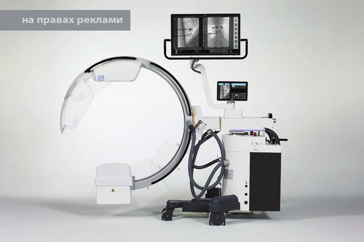 Цифрова рентгенографія та апарати типу C-дуга - інновації в медичній візуалізації