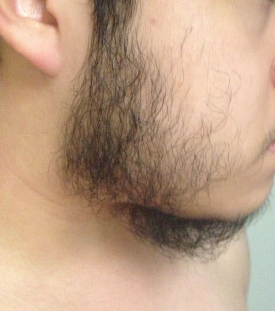 Рост волос на лице у мужчин. Волосы на лице у мужчин.