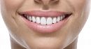 4 главных достоинства отбеливания зубов