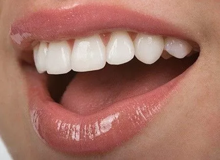 Современные способы выровнять зубы