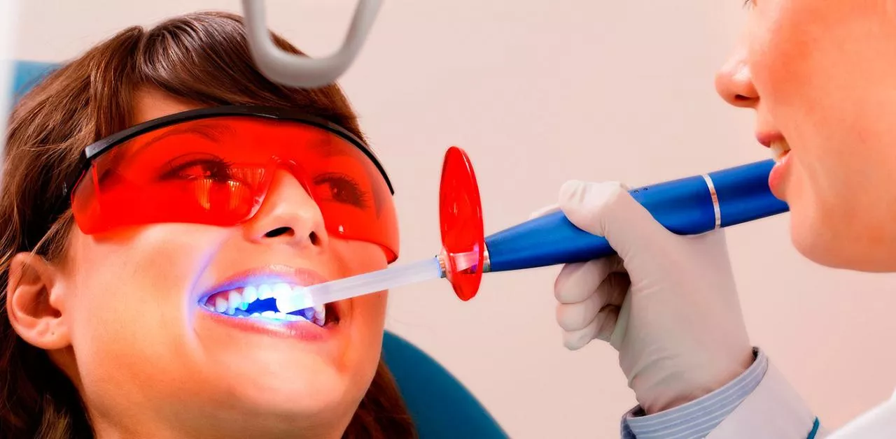 9 видов отбеливания зубов в стоматологии и дома